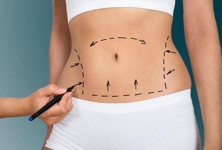 1734371770.148008_838898_image