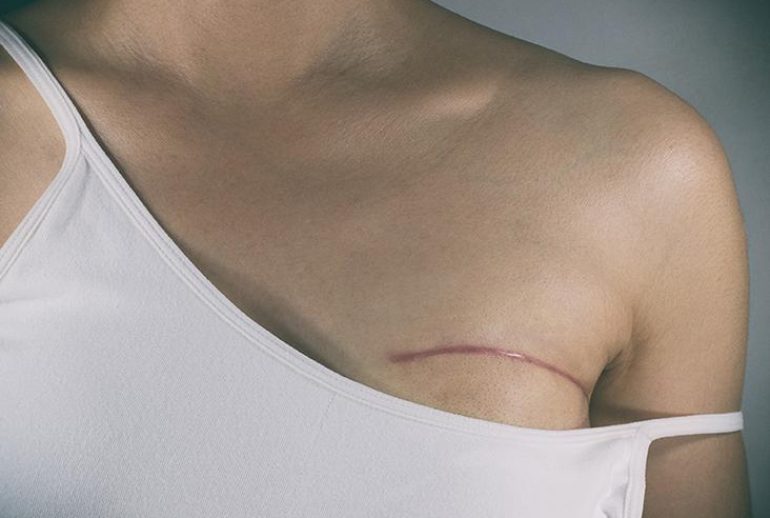 1734371791.509939_174612_image