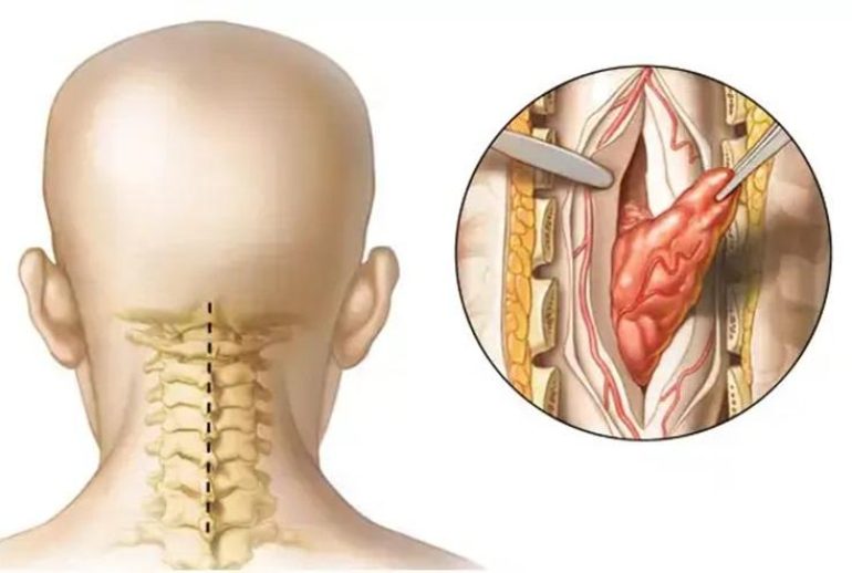 1734371833.794843_257644_image