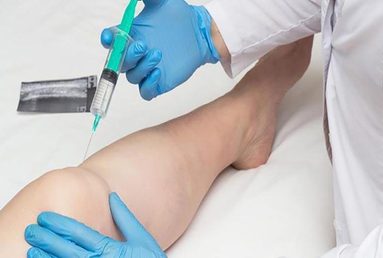 1734371857.710674_952009_image